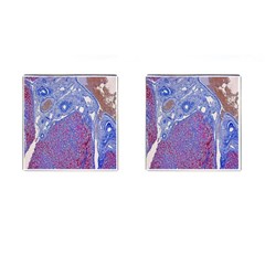 Histology Inc Histo Logistics Incorporated Human Liver Rhodanine Stain Copper Cufflinks (square) by Mariart